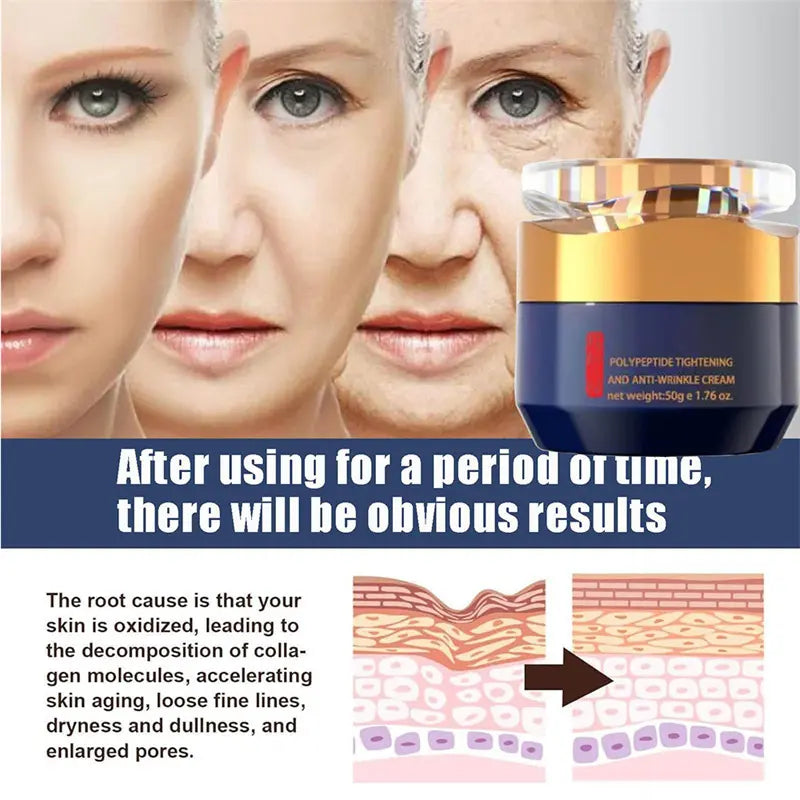 Polypeptide Tightening and Anti-Wrinkle Cream