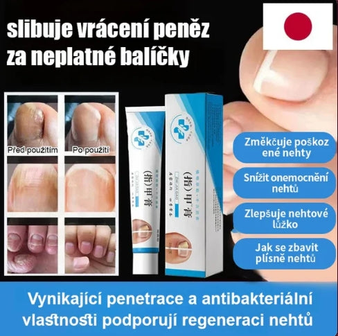 Nail treatment cream
