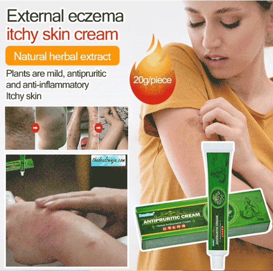External eczema itchy skin cream