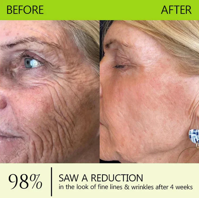 RETINOL SHOT Wrinkle Lift Tightening Cream