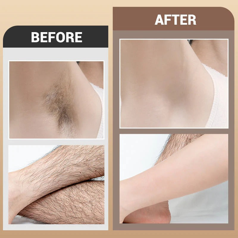 Gentle hair removal cream, suitable for multiple body parts（120g）